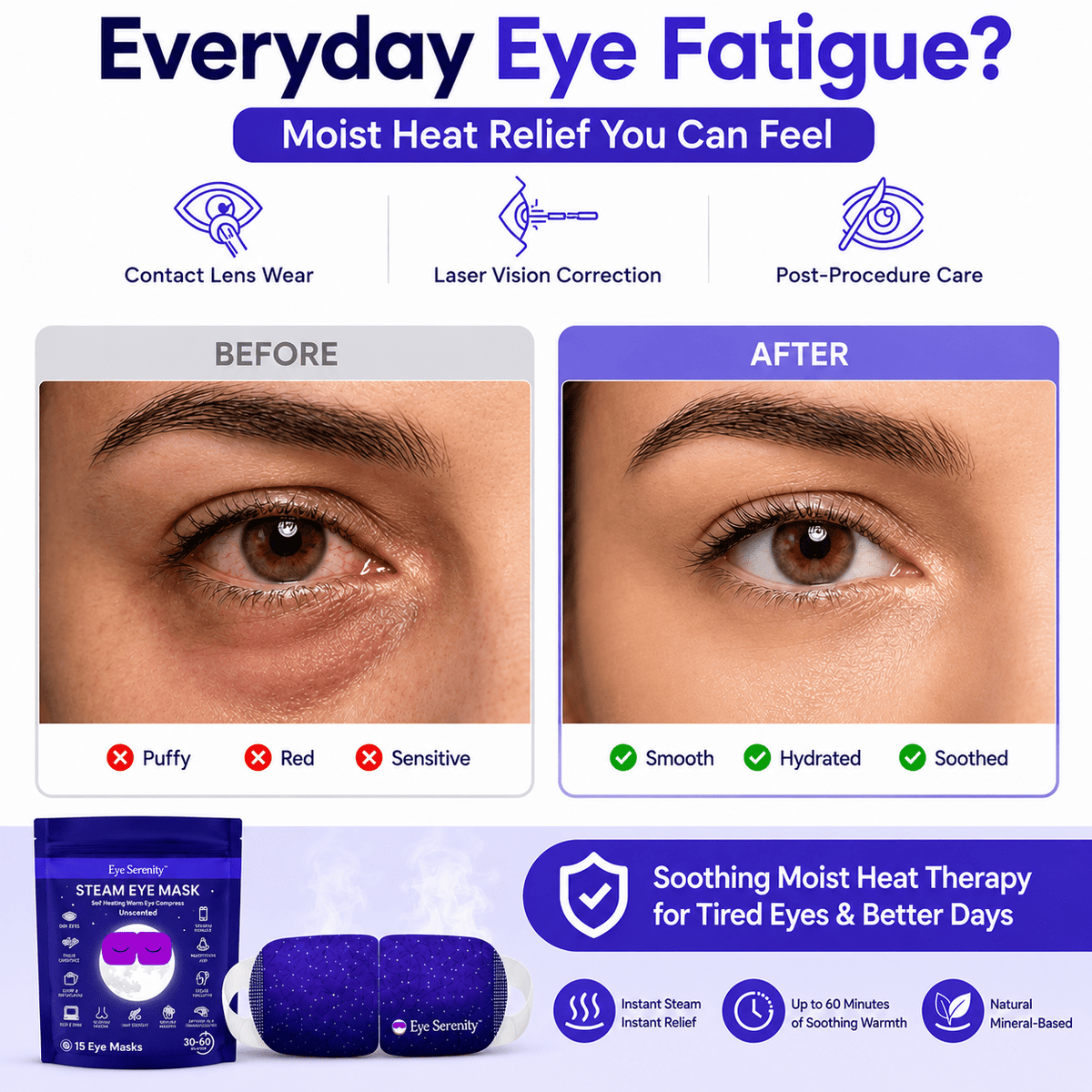 Self-Heating Steam Eye Mask, Single-Use
